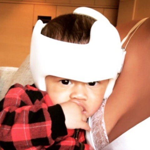 Illustratie bij: Chrissy Teigen deelt een foto van haar zoon met babyhelm – en het hele internet valt haar bij