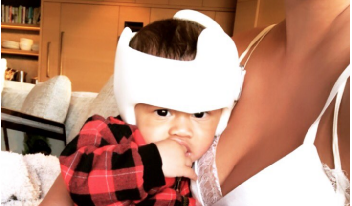 Chrissy Teigen deelt een foto van haar zoon met babyhelm - en het hele internet valt haar bij